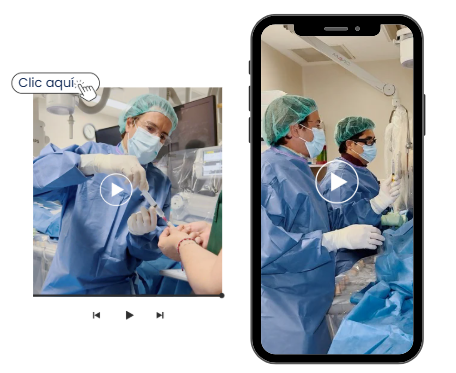 Dr. Sampere realiza una embolización de varices pélvicas