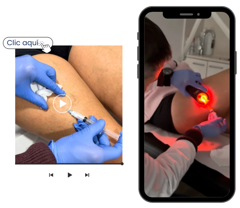 El Doctor Perez realiza tratamientos para varices en las piernas