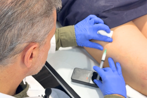 Doctor realizando tratamiento para varices