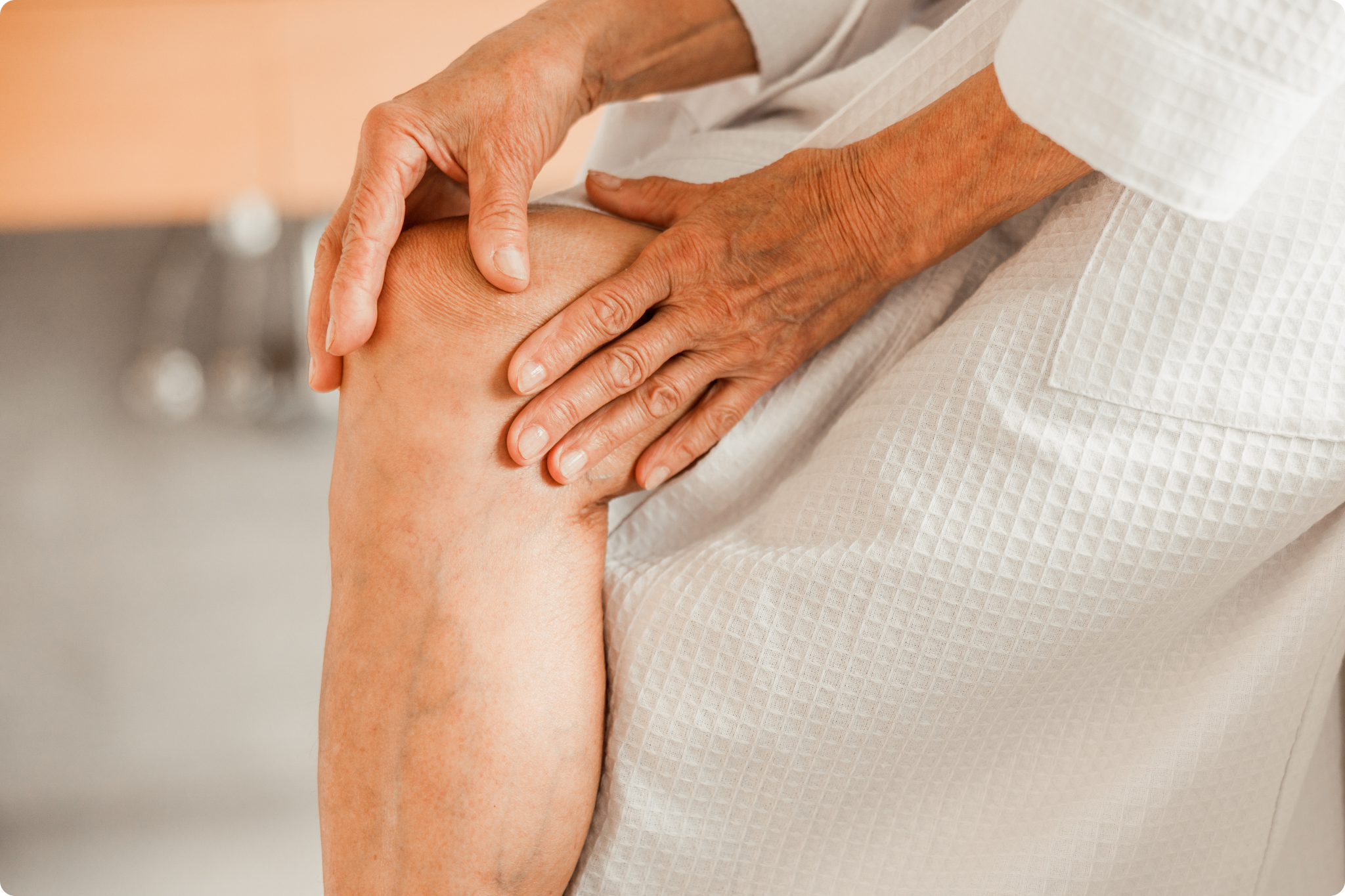 Persona con problema de varices en verano