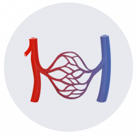 Safenectomía o extracción de la vena safena